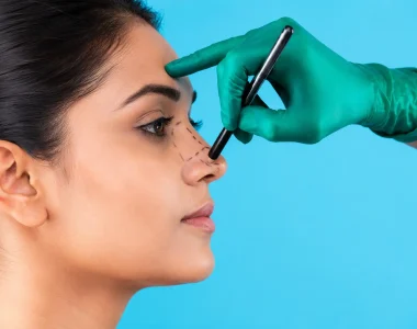 Wide nose correction and natural facial proportions