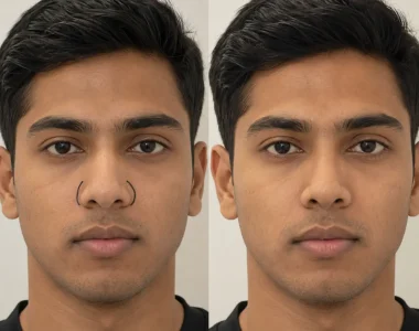 Wide nose correction assessment