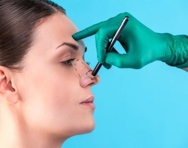 Cosmetic Rhinoplasty