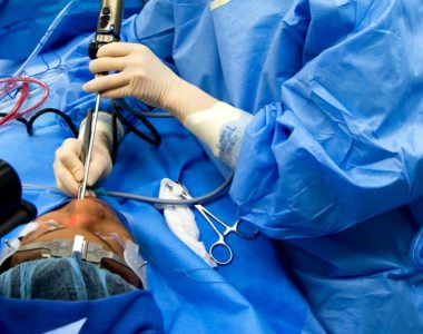 endoscopic-sinus-surgery