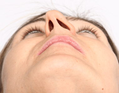 septum-deviation